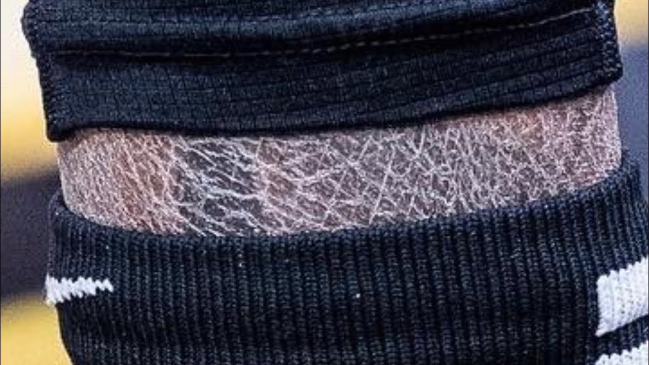 杜兰特谈皮肤龟裂：拍那张照片的人真‘混蛋’ 我一年有350天洗澡